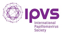 IPVS